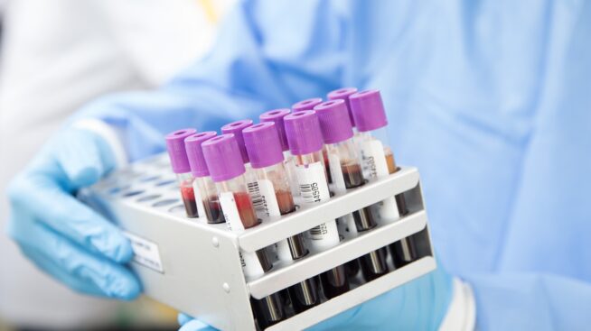 Technician dispensing blood samples in vials