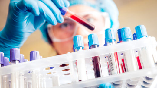 Immunohematology Reference Laboratories Allow Blood Banks to Run More Complex Serologic Tests