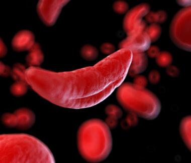 3D rendering of Sickle Cells on red background